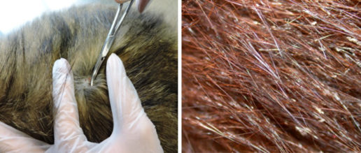 pediculosi